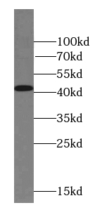      anti- ACTA1-Specific antibody