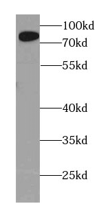 AMPD1-Specific抗體
