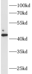 Alpha-sarcoglycan抗體