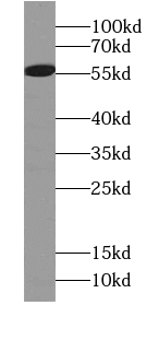 ARHGEF9-Specific抗體