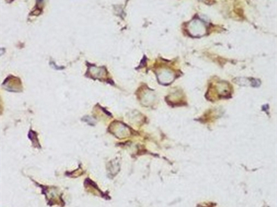 AEG-1/MTDH-Specific抗體
