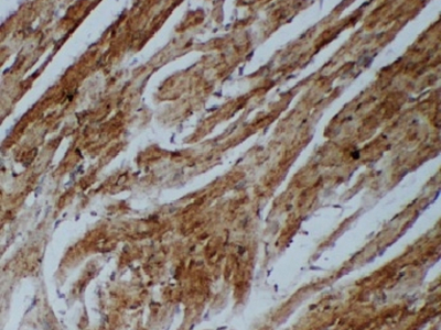Angiopoietin 2抗體