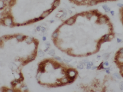 ATP1A1-Specific抗體