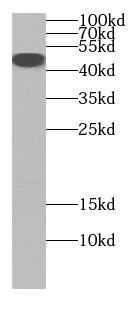 Beta sarcoglycan抗體