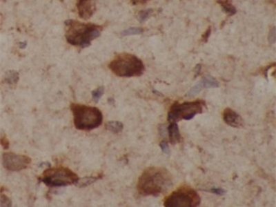 alpha-synuclein抗體