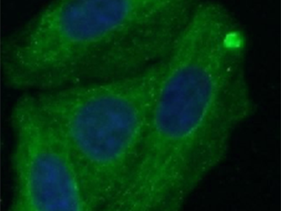 Alpha-1-Antitrypsin抗體