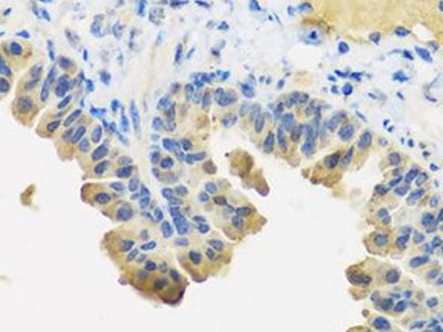 Angiopoietin 1抗體
