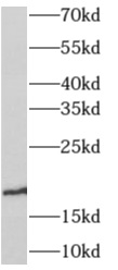      anti- Angiogenin antibody