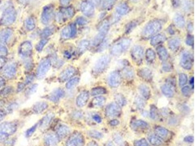 Aminoacylase 1抗體