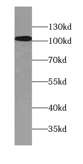 ATP13A1抗體