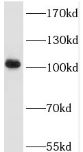      anti- TRAK2 antibody