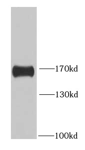 anti- HDAC6 antibody