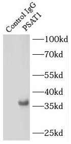 anti- PSAT1 antibody