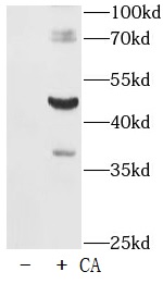 Phospho-Tau-T181 抗體
