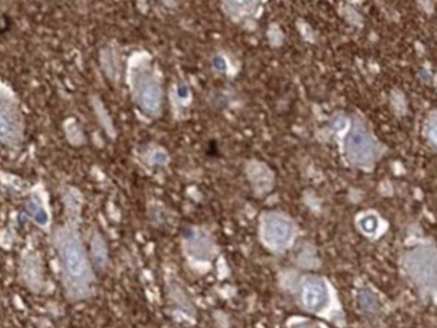 alpha-synuclein抗體