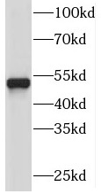 PI4K2A抗體
