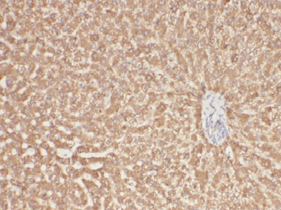 Angiotensinogen抗體
