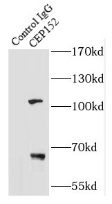 CEP152抗體