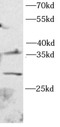 ARG1抗體