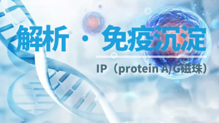 免疫沉淀（IP）實(shí)驗(yàn)7大常見(jiàn)問(wèn)題及解決方案