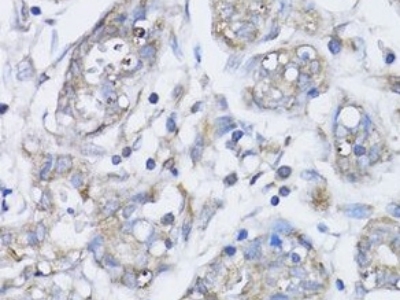 BRCA1抗體
