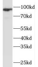      anti- NBN antibody