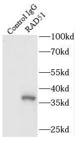 RAD51抗體