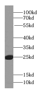      anti- RAB27A-specific antibody