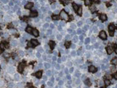 ribosomal protein L4抗體