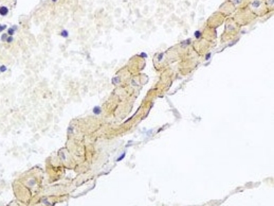 CD81抗體