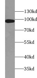      anti- PDCD6IP antibody