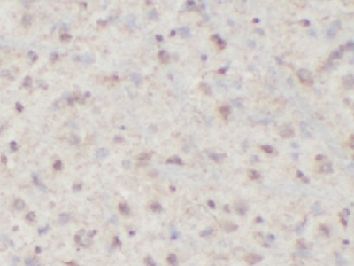 HSP70抗體