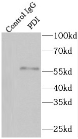      anti- PDI antibody