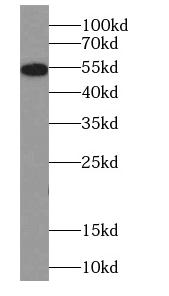     anti- CYP2E1-Specific antibody