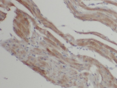      anti- LC3B-Specific antibody