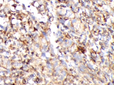      CD8抗體