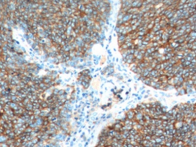 NCAM1/CD56抗體