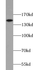 CD11B/Integrin alpha M抗體