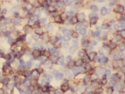 CD11B/Integrin alpha M抗體