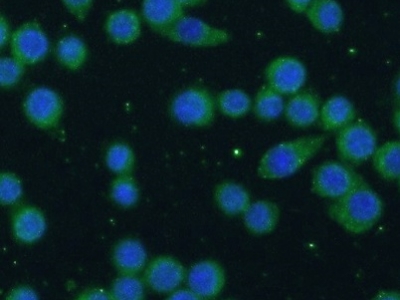     CD80抗體