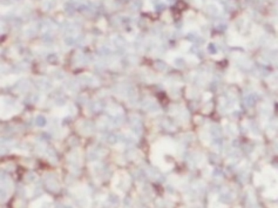      CD80抗體