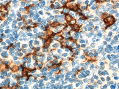      CD163/M130抗體