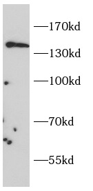      CD163抗體