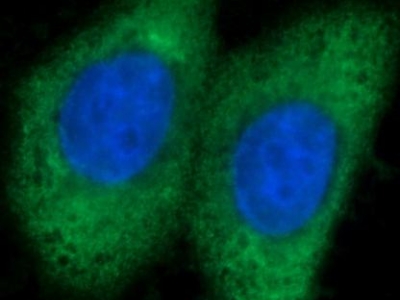      liver Arginase抗體