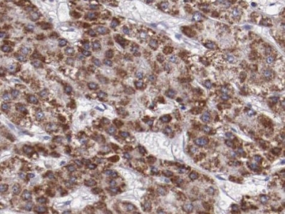      liver Arginase抗體