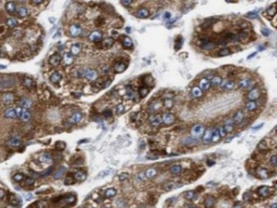      liver Arginase抗體