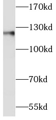      E-cadherin抗體