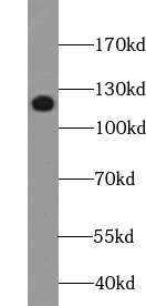 E-cadherin抗體