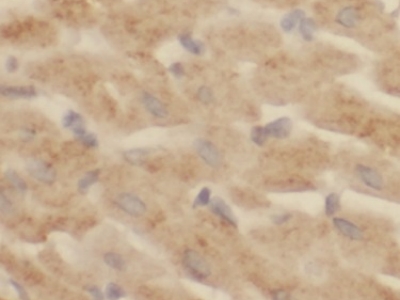      N-cadherin抗體