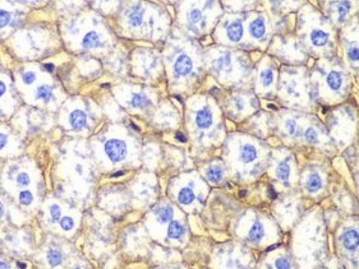 N-cadherin抗體